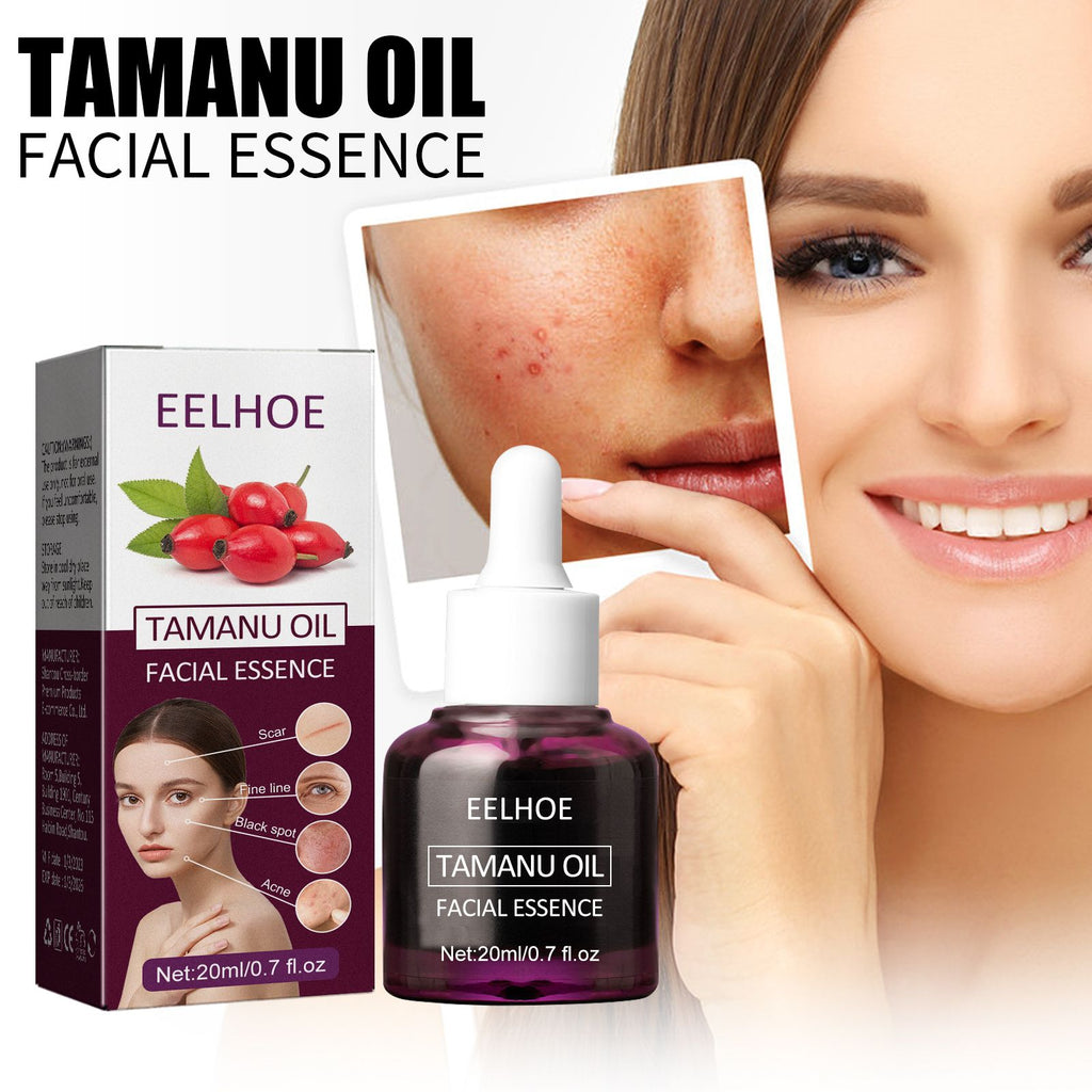 EELHOE Tamanu Facial Oil, s Acne Marks Fine Lines Moisturizes and Firms Skin Essential Oil