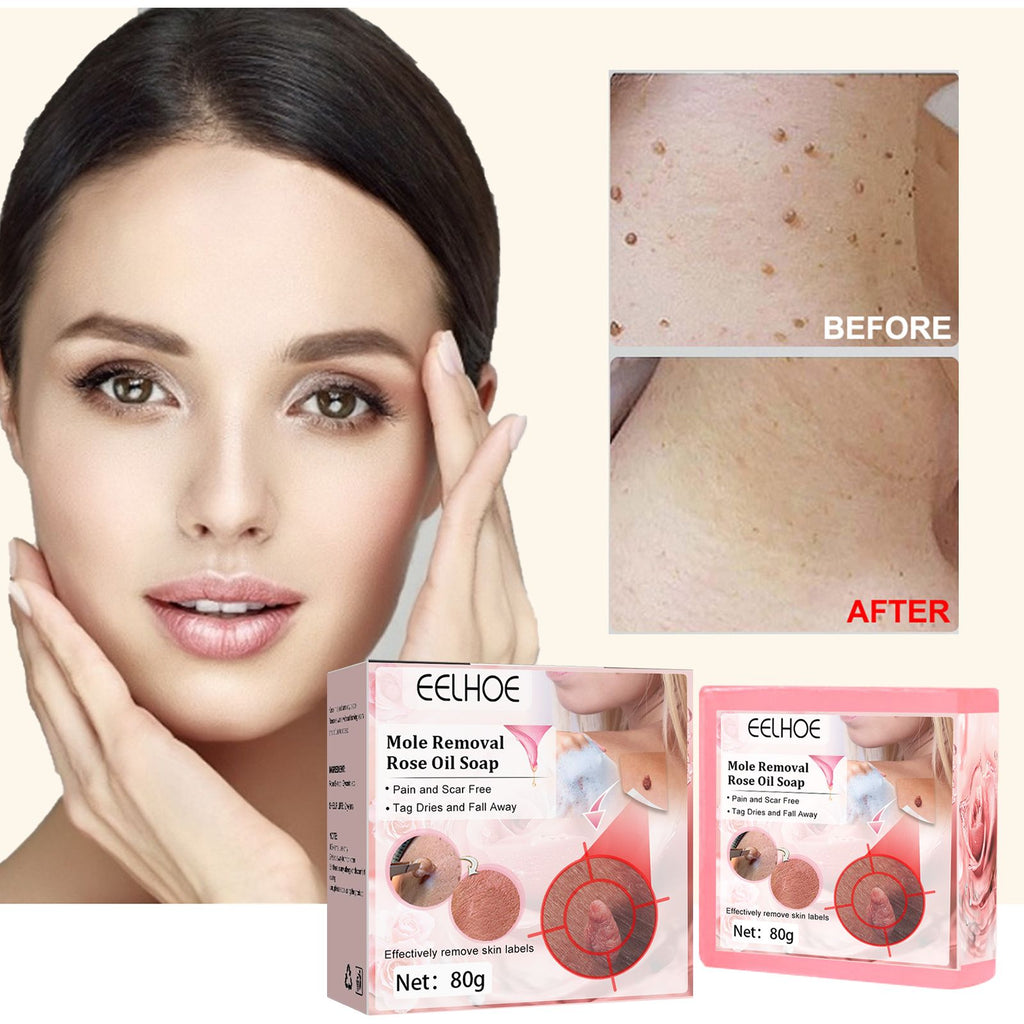 EELHOE Verruca Rose Essential Oil Soap Cleaning Nevus Verruca Face And Neck Silk Verruca Essence Soap