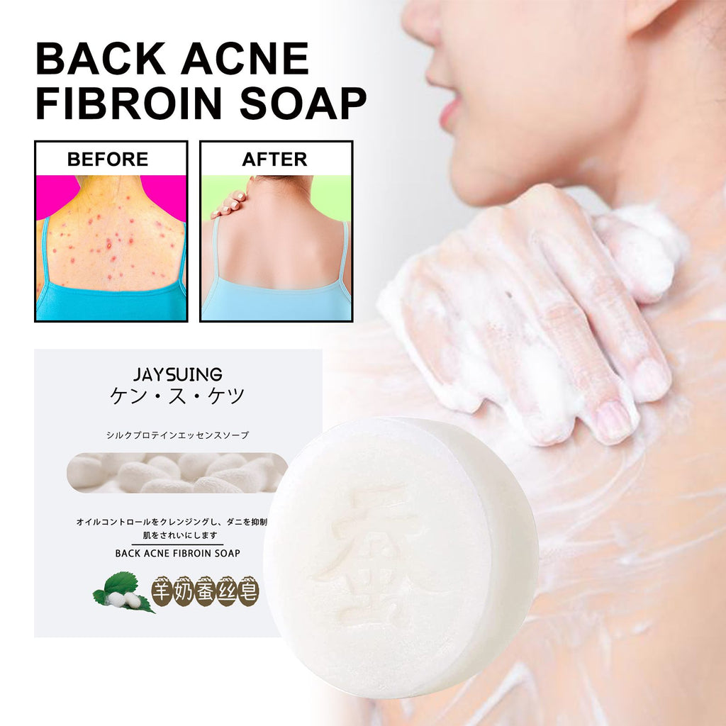 Jaysuing Back Silk Soap, Cleanser Acne Pimple Beauty Back Moisturizing Bath Soap