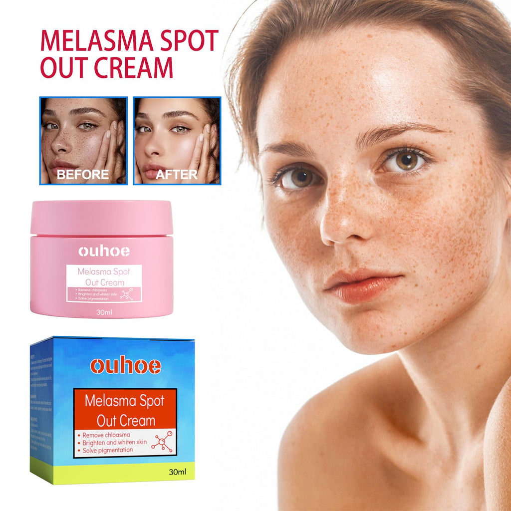 OUHOE Blemish Cream, Skin Melasma Stains And Hydrating Cream