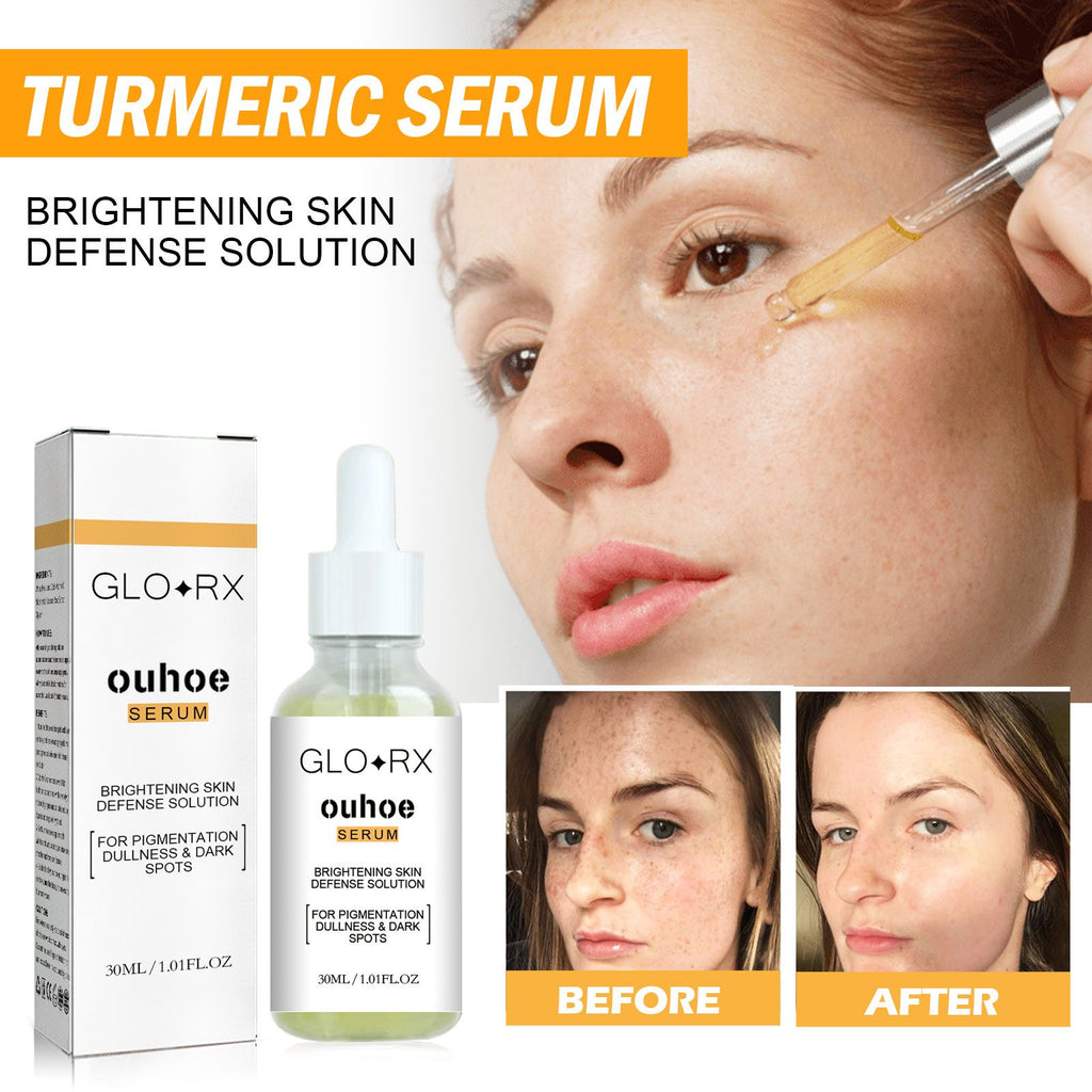 OUHOE Turmeric Spot Serum, Lighten Freckle Spots Brightening Skin Hydrating Serum